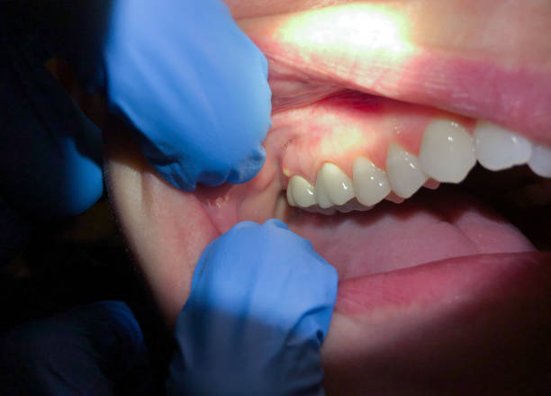 Best Emergency Dentist for Special Needs Patients in Crump, TN