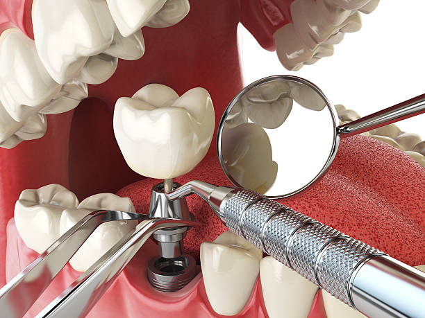 Best Emergency Dental Care for Abscessed Tooth in Crump, TN